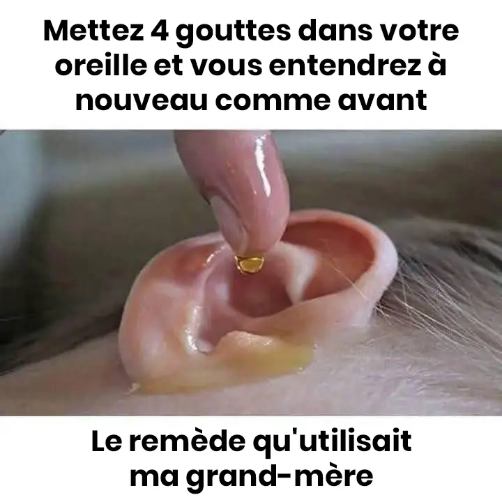 Recette de grand mere mettez 4 gouttes dans votre oreille et vous entendrez comme avant.jpg