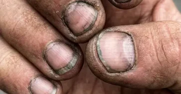 Comment appelle t on une personne qui a des ongles comme ca.jpg (1)