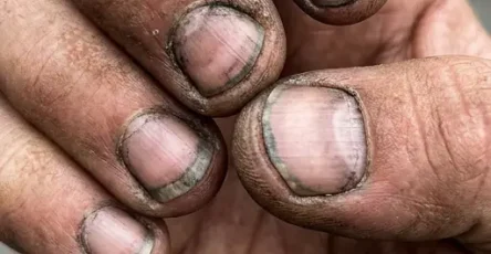 Comment appelle t on une personne qui a des ongles comme ca.jpg (1)